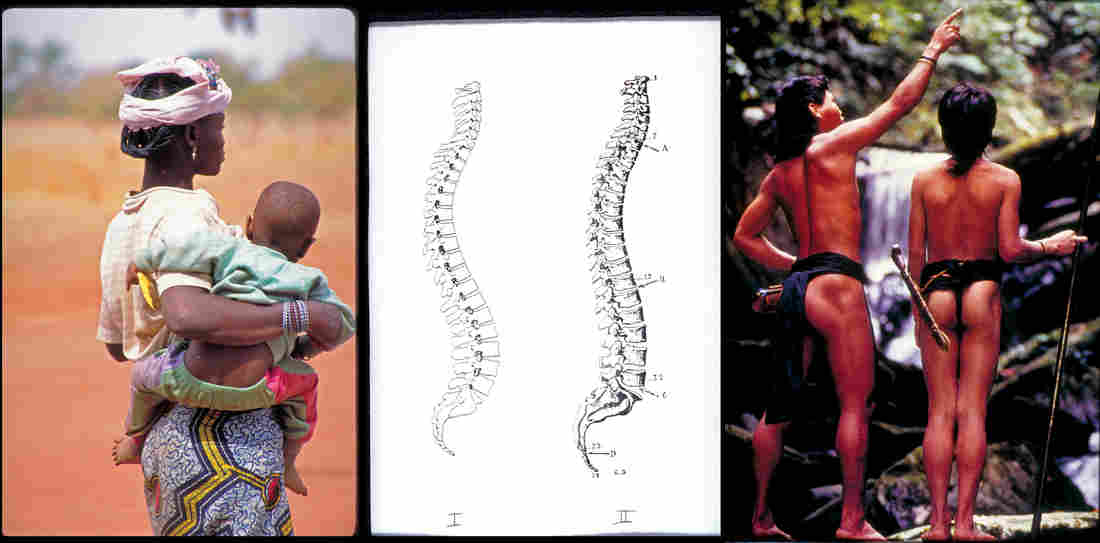 Lost Posture: Why Some Indigenous Cultures May Not Have Back Pain